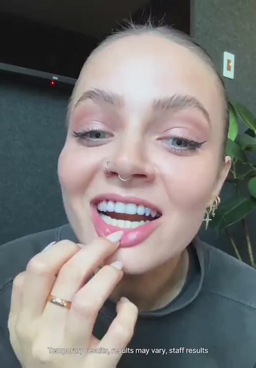 V34 Whitening Strips